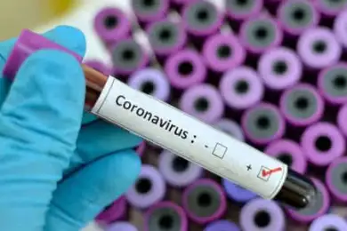 В Казахстане выявили 686 случаев заражения коронавирусом 