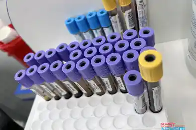 За сутки 22 случая коронавируса выявили в Казахстане