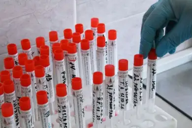 По всему Казахстану за сутки выявили 245 новых зараженных коронавирусом 