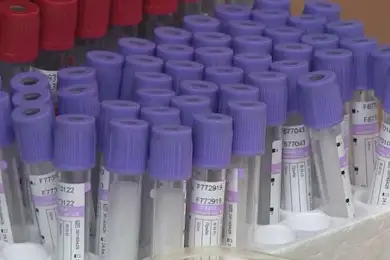 Число заболевших коронавирусом в РК превысило 11000 пациентов 