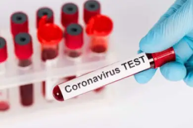 Только в двух городах и областях РК выявили случаи коронавируса за сутки 