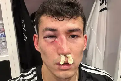 Зайнутдинов получил жуткую травму перед матчем в Астане 