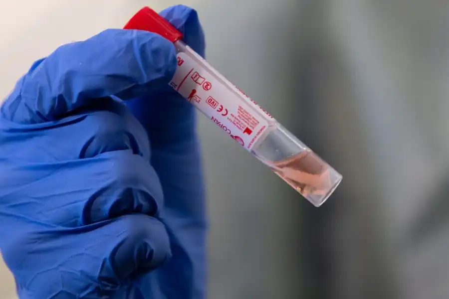 Два новых случая в Алматы с COVID19, по Казахстану - теперь 137 пациентов 