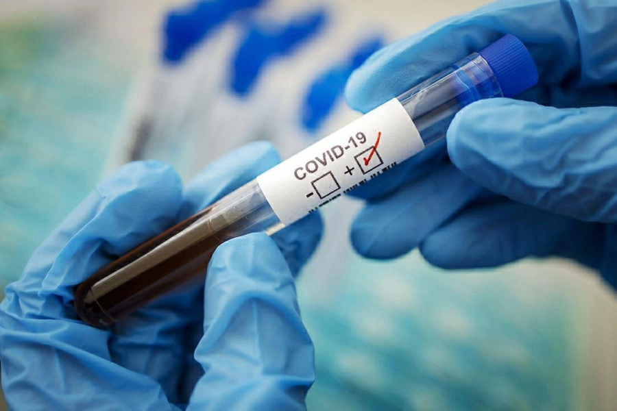 В РК 263 казахстанца заразились коронавирусом 