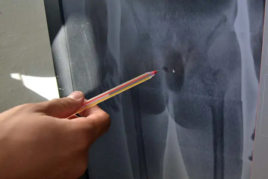 В Караганде осужденный пытался пронести в прямой кишке телефон и наркотики 