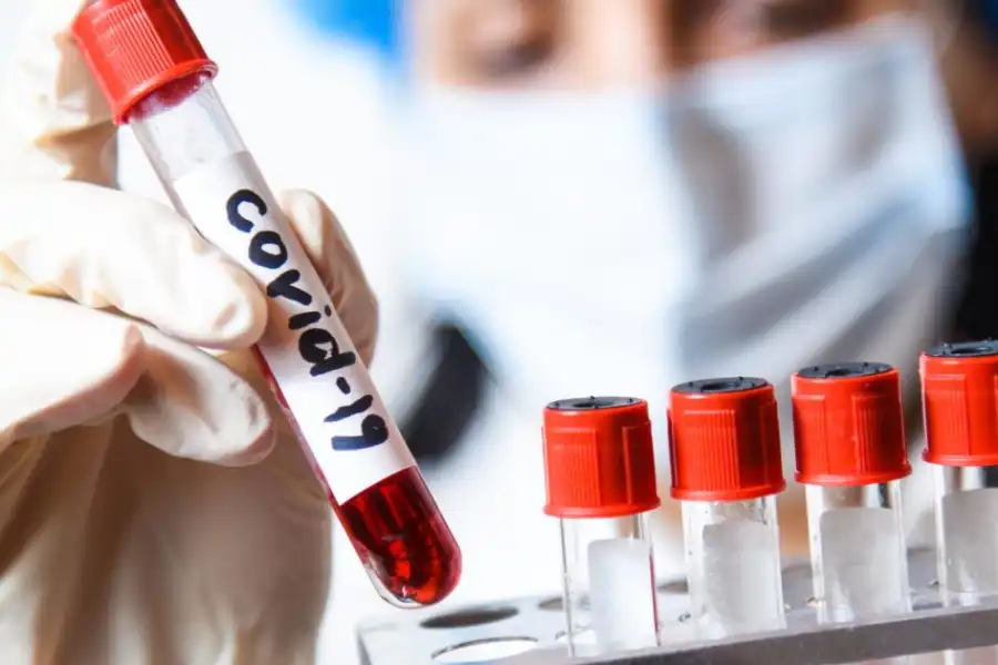 В Казахстане число зараженных коронавирусом достигло 3920 