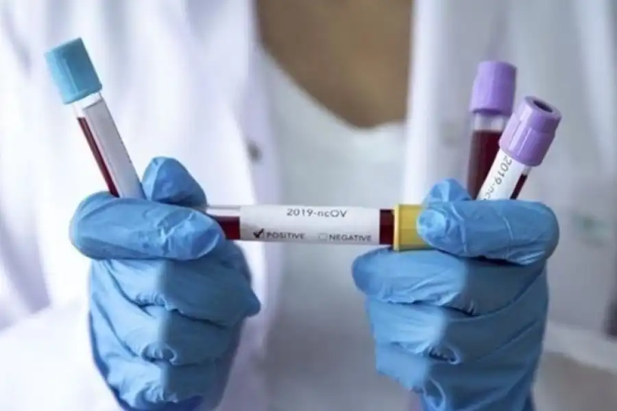 Минздрав скорректировал данные по зараженным в РК 