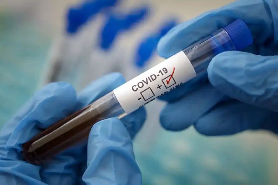 У близких скончавшегося астанчанина диагностировали коронавирус 