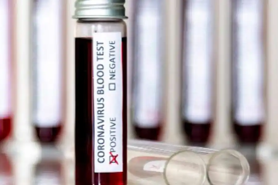 Как сразу 19 человек в Акмолинской области заразились от одного источника  