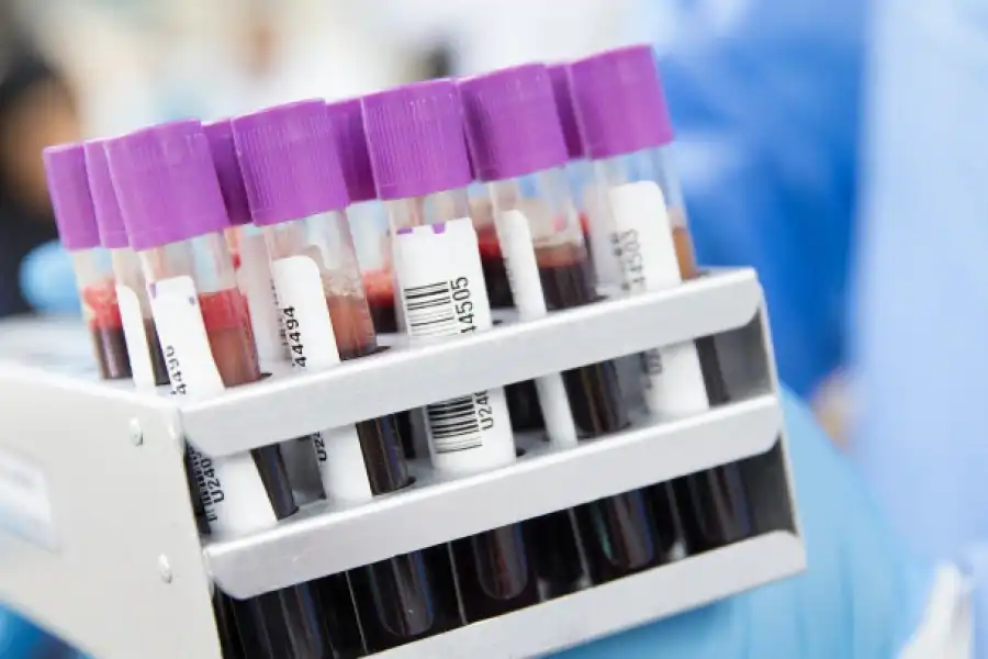 На Тенгизе число зараженных коронавирусом достигло 269 вахтовиков 