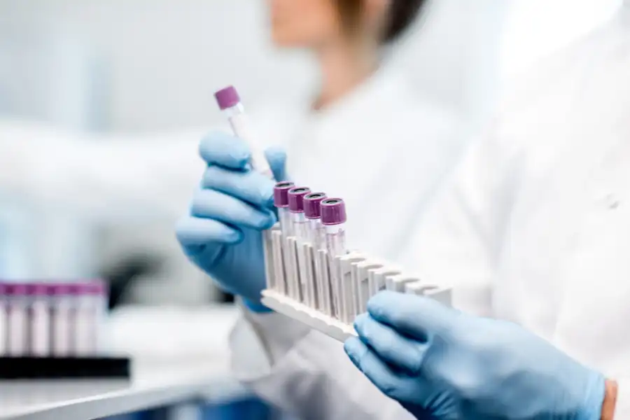 COVID19: в Казахстане увеличат число мобильных лабораторий 