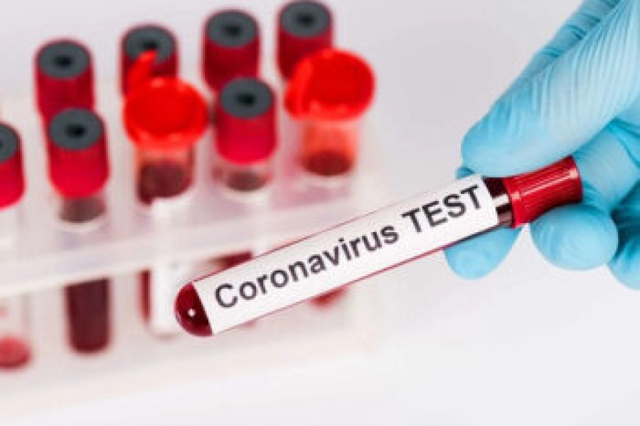 За сутки в Казахстане выявили 1445 случаев коронавируса 