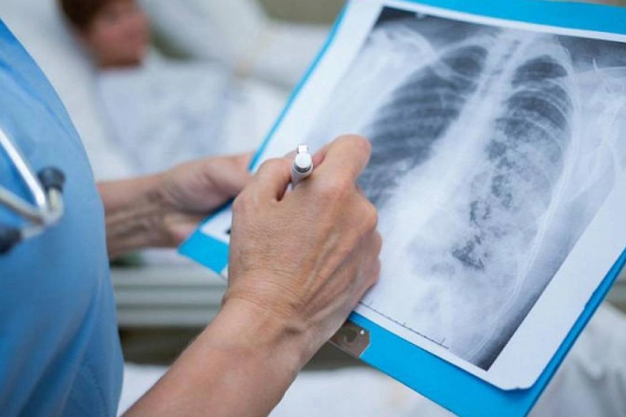 В Казахстане 52 человека заболели пневмонией с признаками коронавируса 