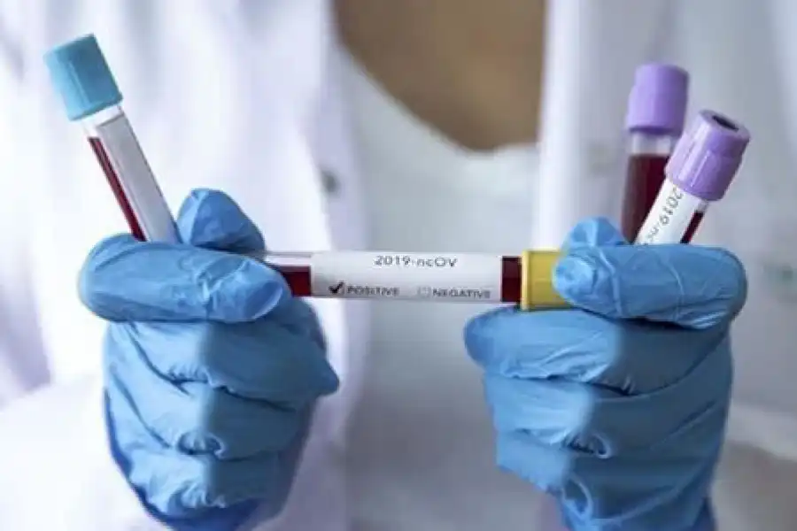 118 человек контактировали с пациентом, скончавшимся от коронавируса 