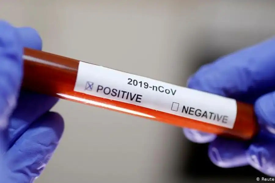 В Казахстане выявили еще 36 новых зараженных коронавирусом  